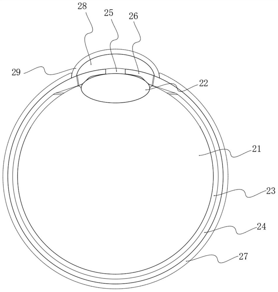 Eyeball model for ophthalmological corneal puncture operation teaching