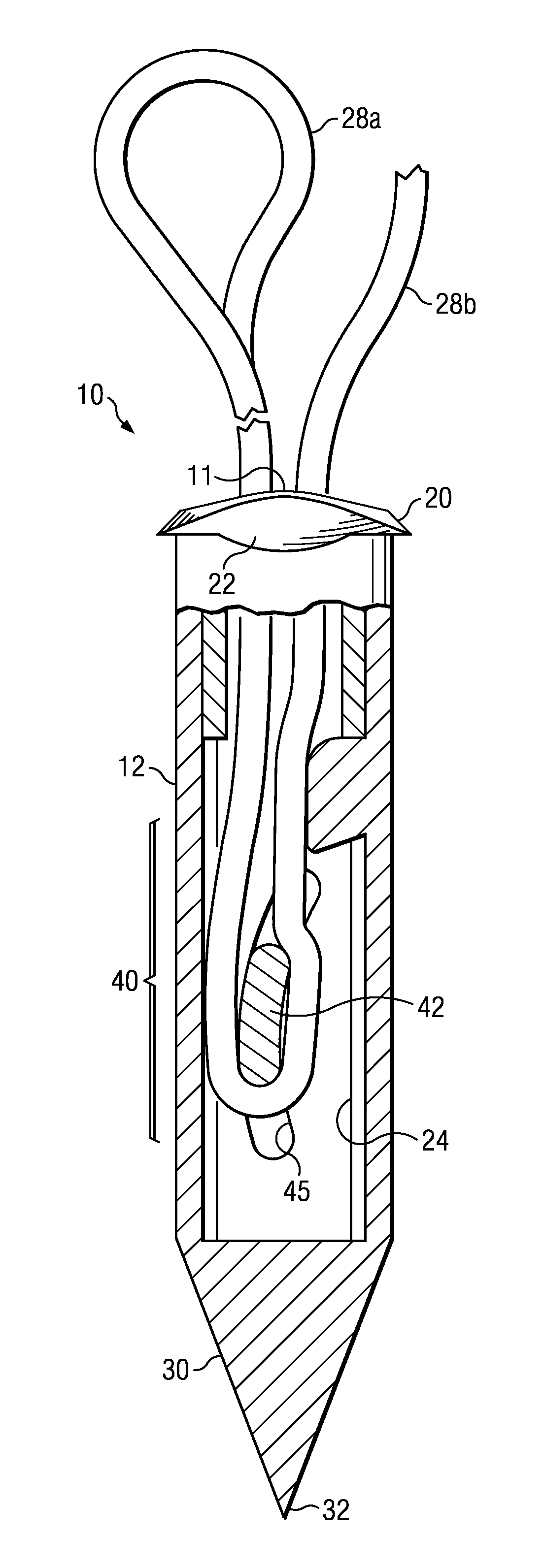 Restricted wedge suture anchor and method for soft tissue repair