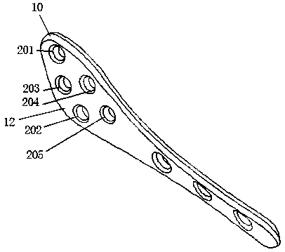 Fixation system for spinae scapulae during anatomy