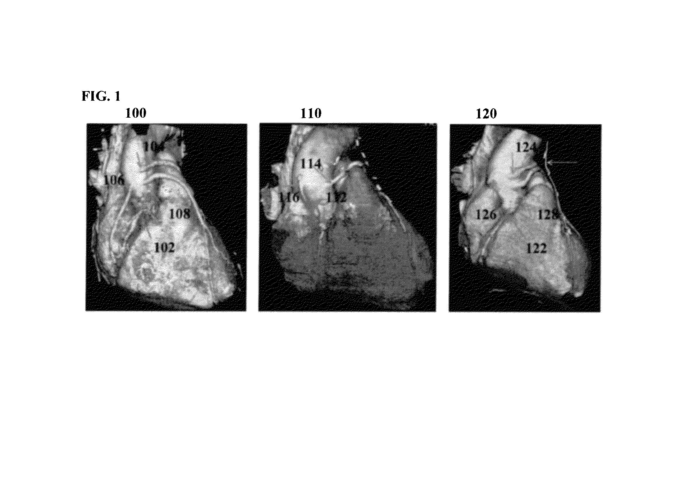 Method and system for automatic native and bypass coronary ostia detection in cardiac computed tomography volumes