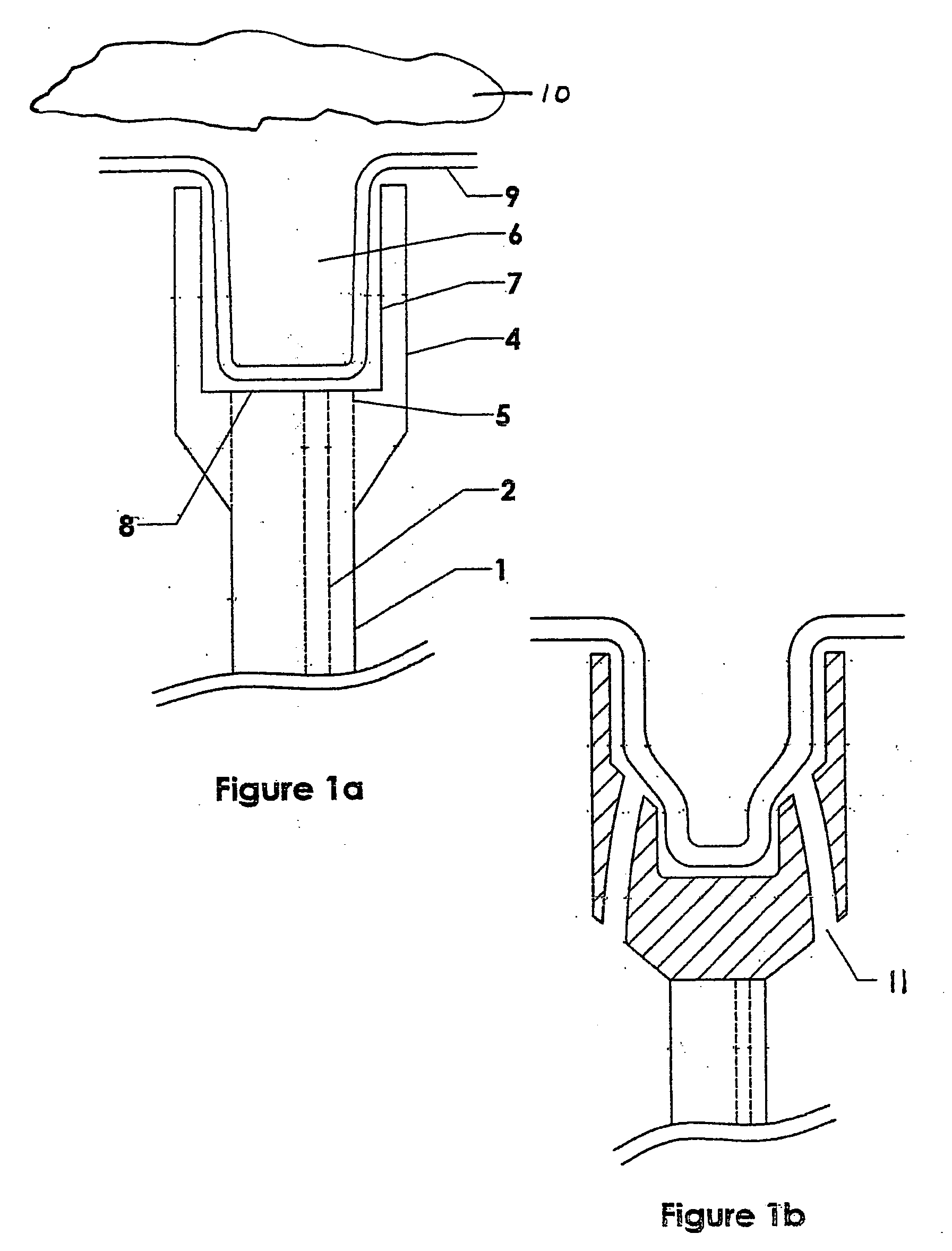 Methods and devices for anchoring to soft tissue