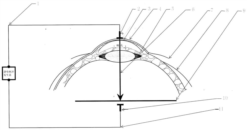 Electrostatic pulse amblyopia therapeutic instrument