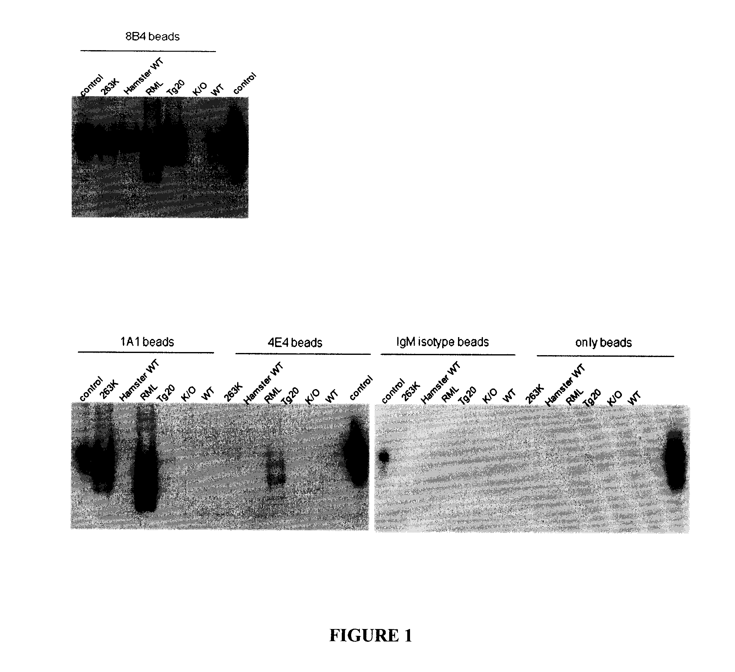 Antibodies And Epitopes Specific To Misfolded Prion Protein