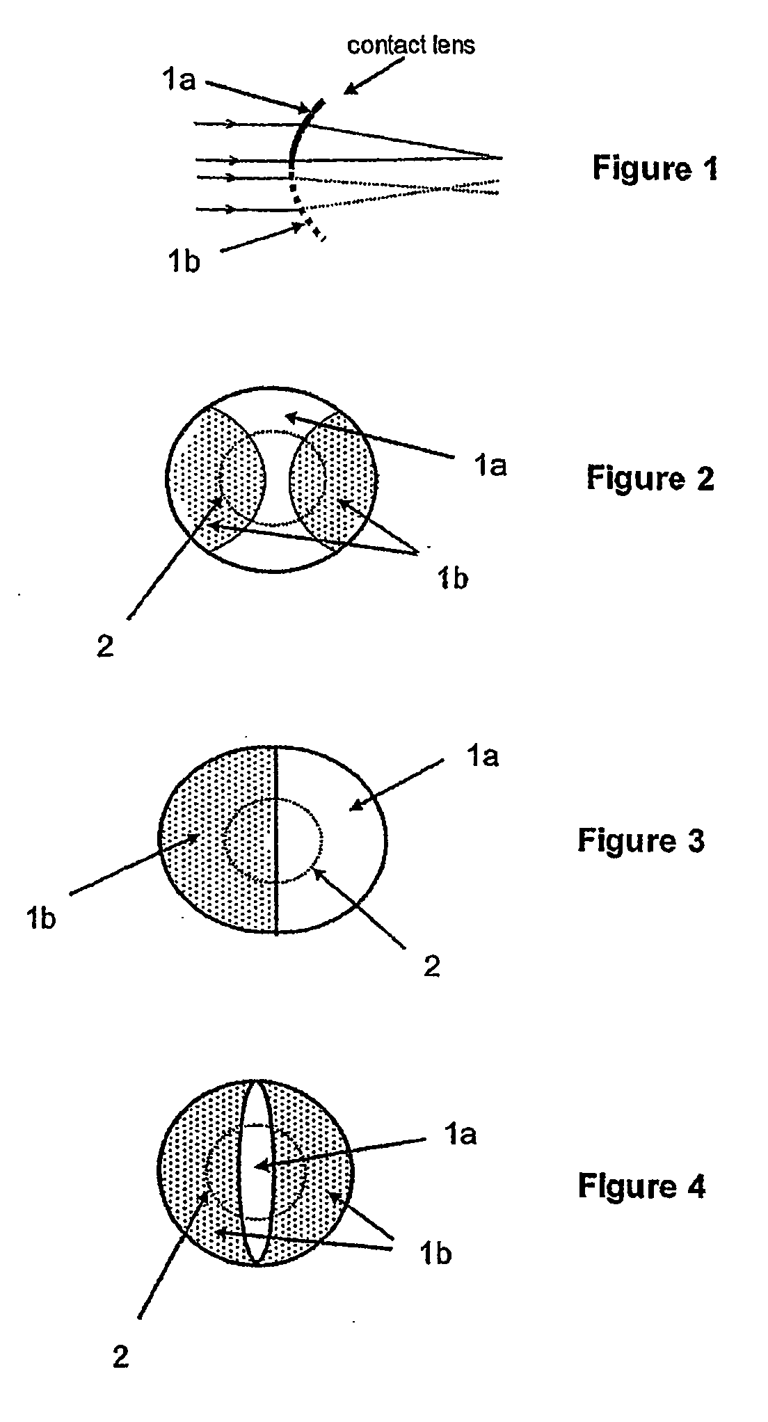 Contact Lens and Method for Prevention of Myopia Progression