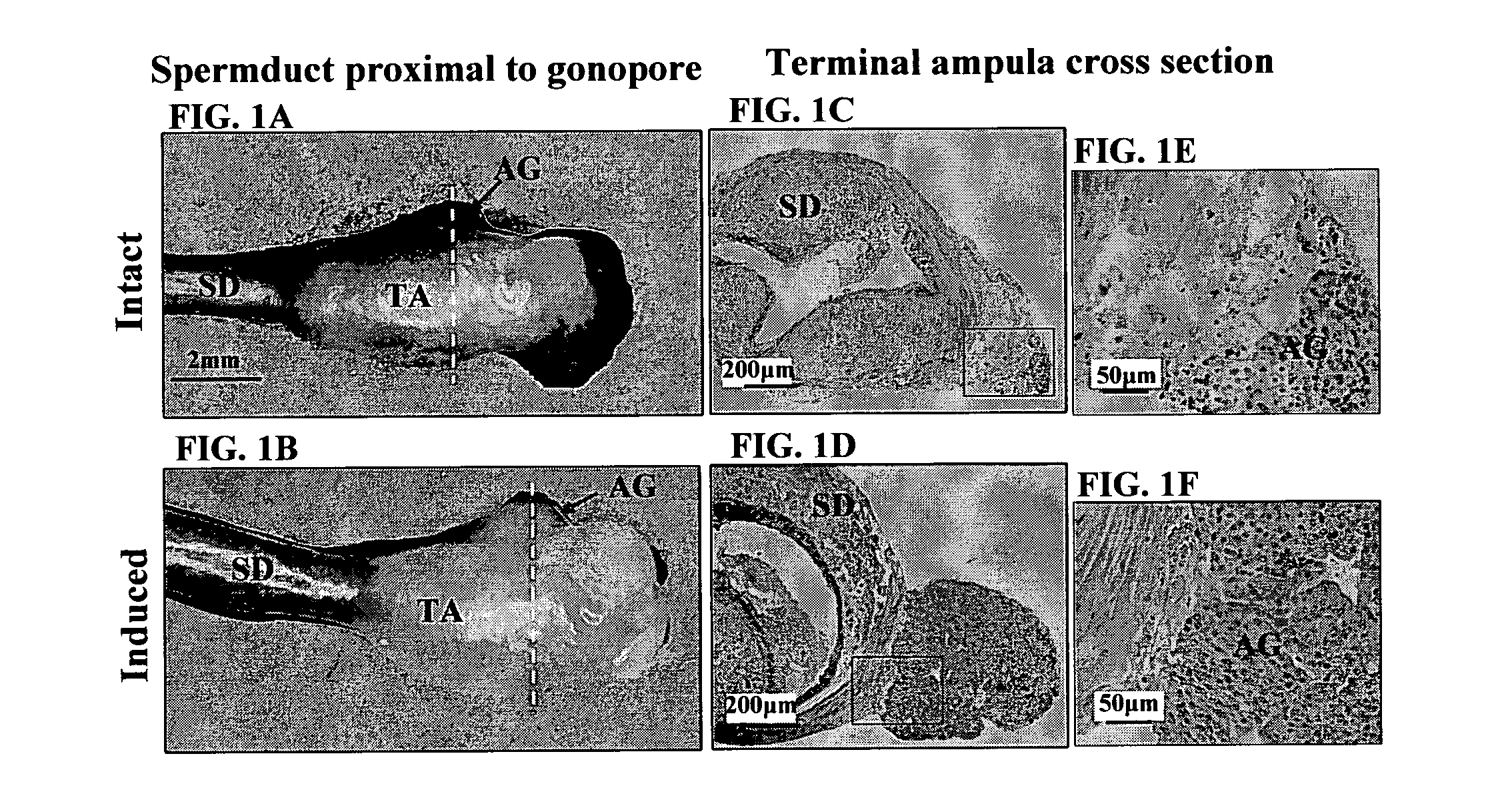 Insulin-like gene of prawns and uses thereof