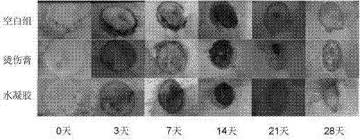 Breviscapine/chitosan composite hydrogel restraining cicatrization and preparation method thereof