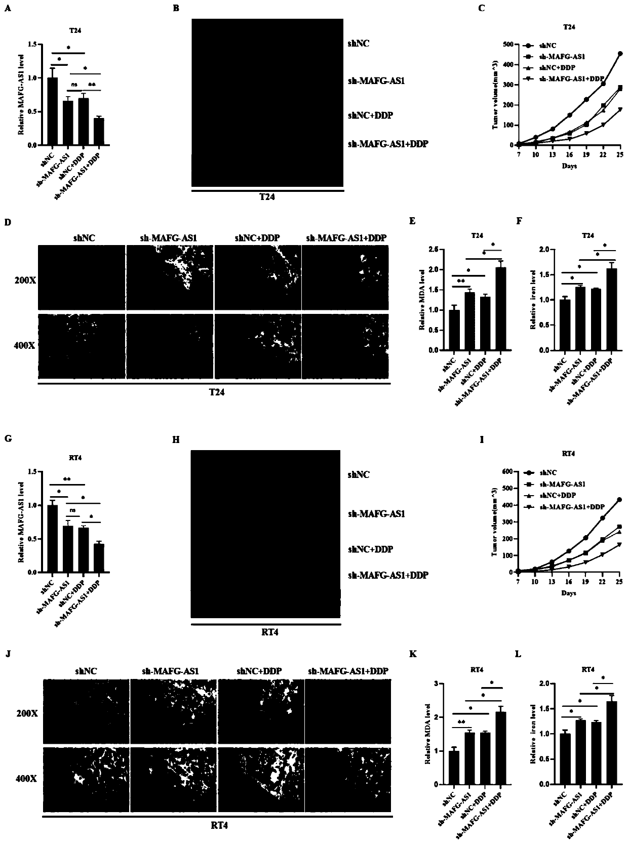 Application of MAFG-AS1/PCBP2/FPN1 regulation axis as target site detection reagent in preparation of medicine for treating bladder cancer