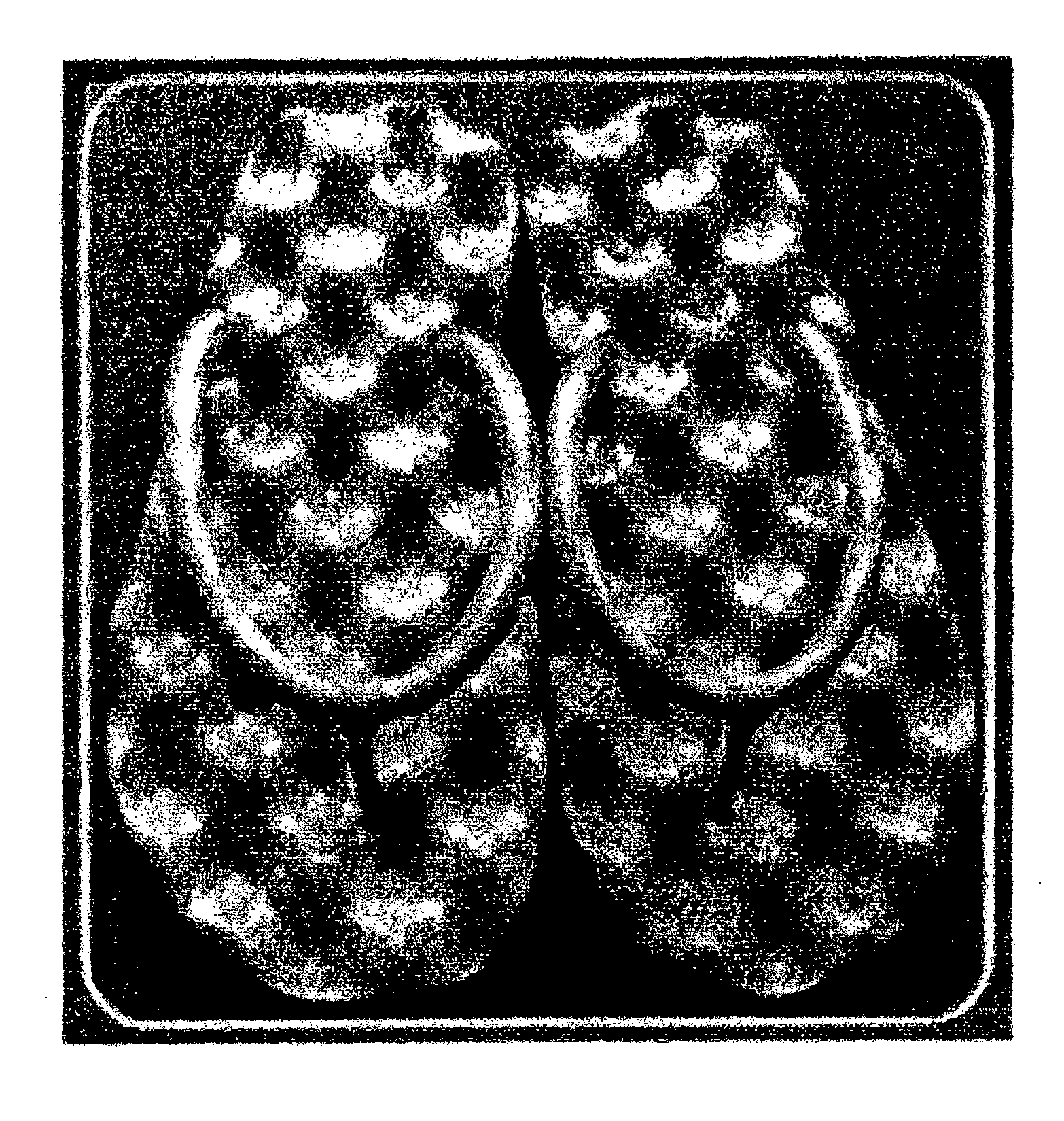 Massaging footbed having sole with pattern of waves and method of making same