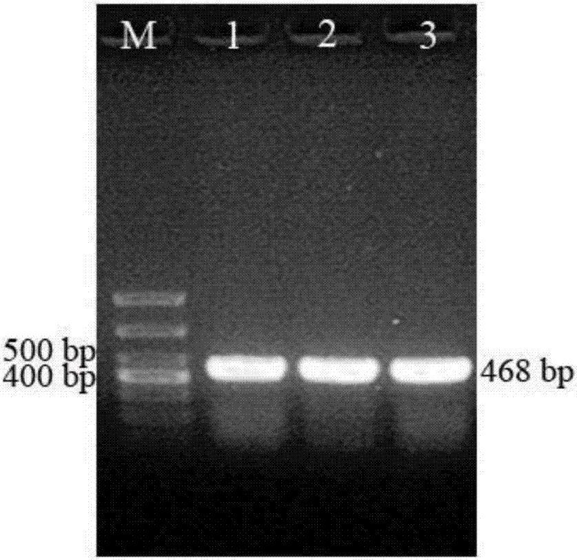 Halogeton glomeratus salt-tolerant gene HgS3 and applications thereof