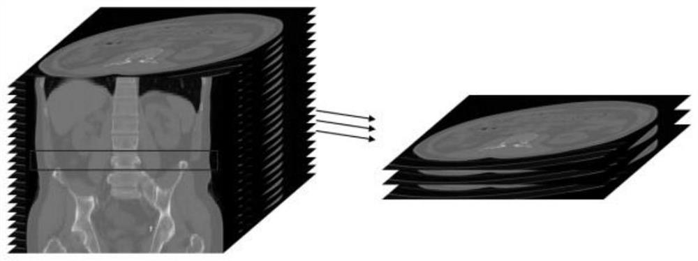 Body composition automatic measurement system based on abdomen CT image and deep learning