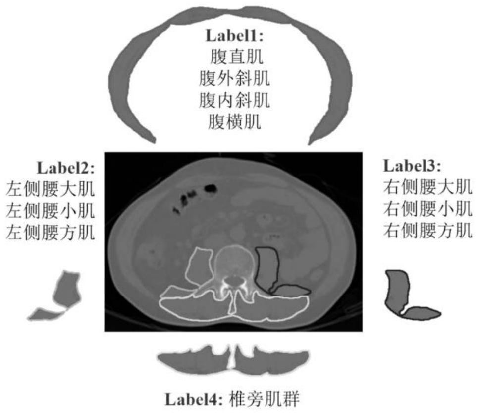 Body composition automatic measurement system based on abdomen CT image and deep learning