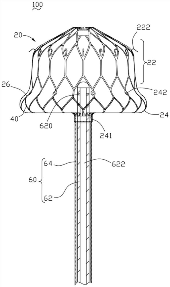 Safety-improved left auricle ablation plugging device