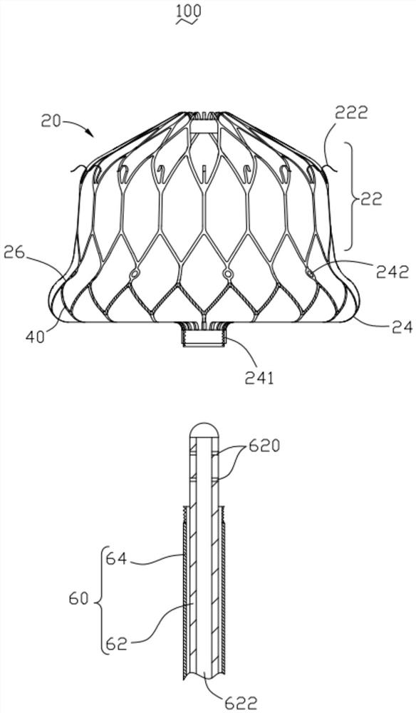 Safety-improved left auricle ablation plugging device