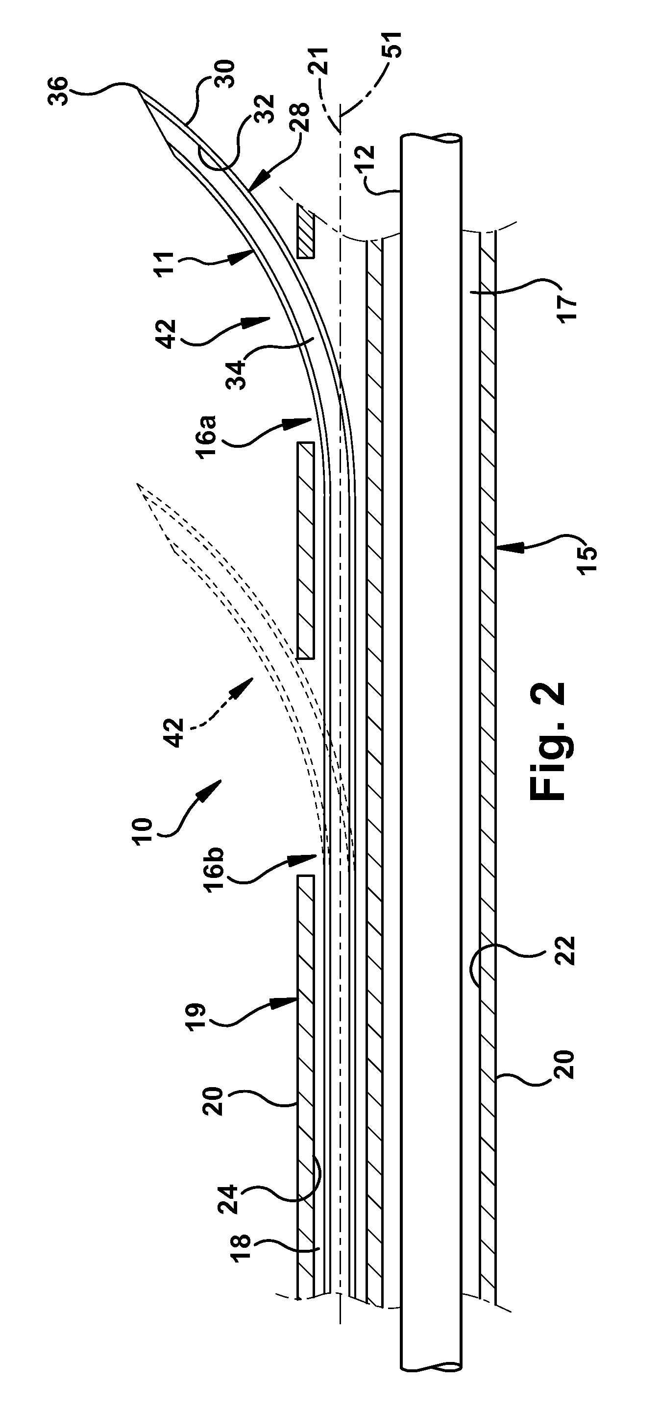 Catheter assembly and method of treating a vascular disease