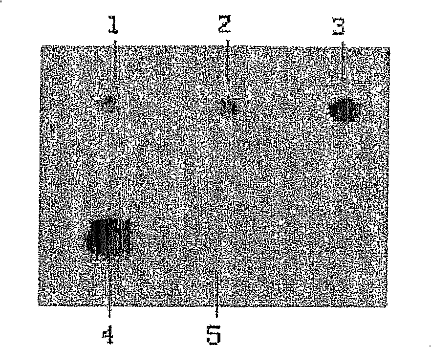 A recombinant virus comprising BPI gene and a pharmaceutical composition containing the same and uses thereof