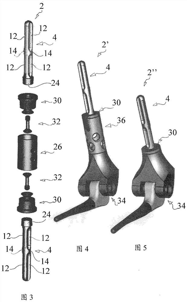 Binder retention implant standle for