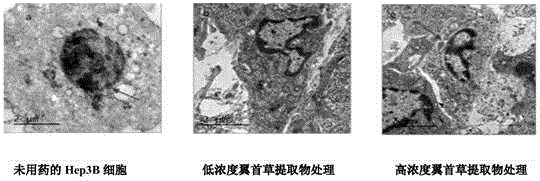 Pterocephalus hookeri heck n-butyl alcohol extract, as well as preparation method and application thereof