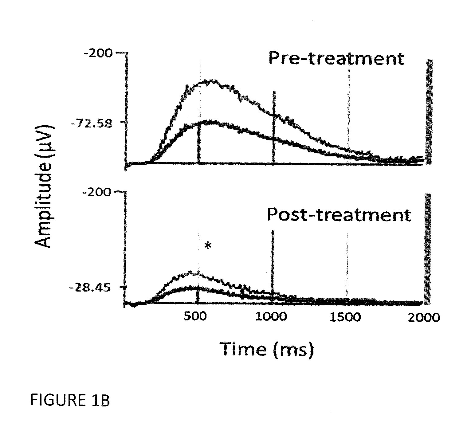 Autoimmune-Induced Glutamatergic Receptor Dysfunction Methods and Treatments