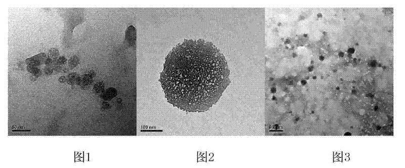 Chitosan nano particles embedded with alpha-galactosidase and preparation method thereof