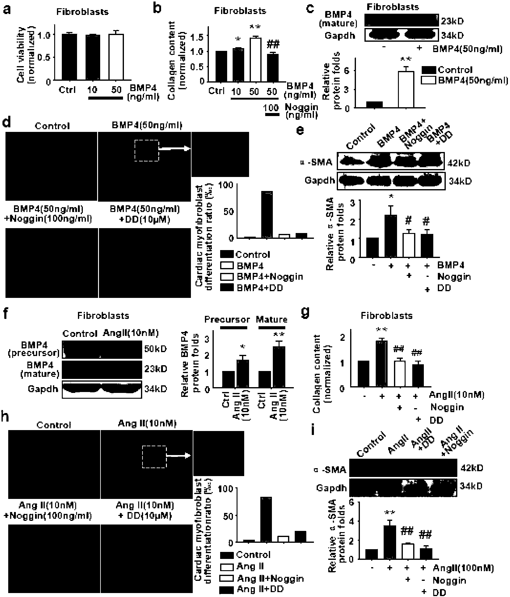 Application of bone morphogenic protein-4 in screening anti-cardiac hypertrophy, anti-heart failure or anti-cardiac fibrosis drugs