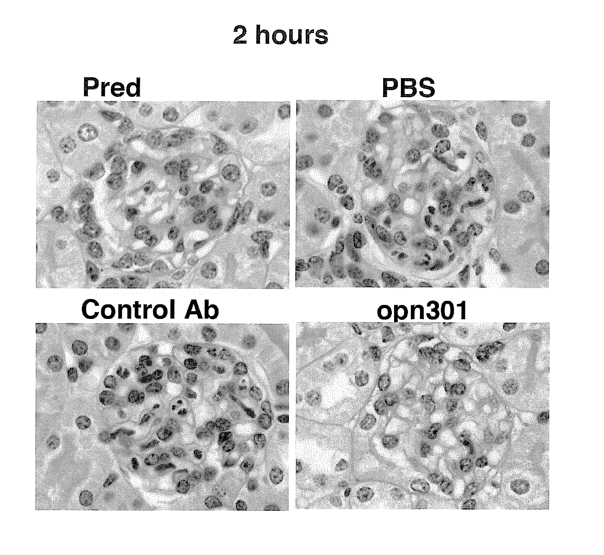 Compounds and methods for the treatment of renal disease