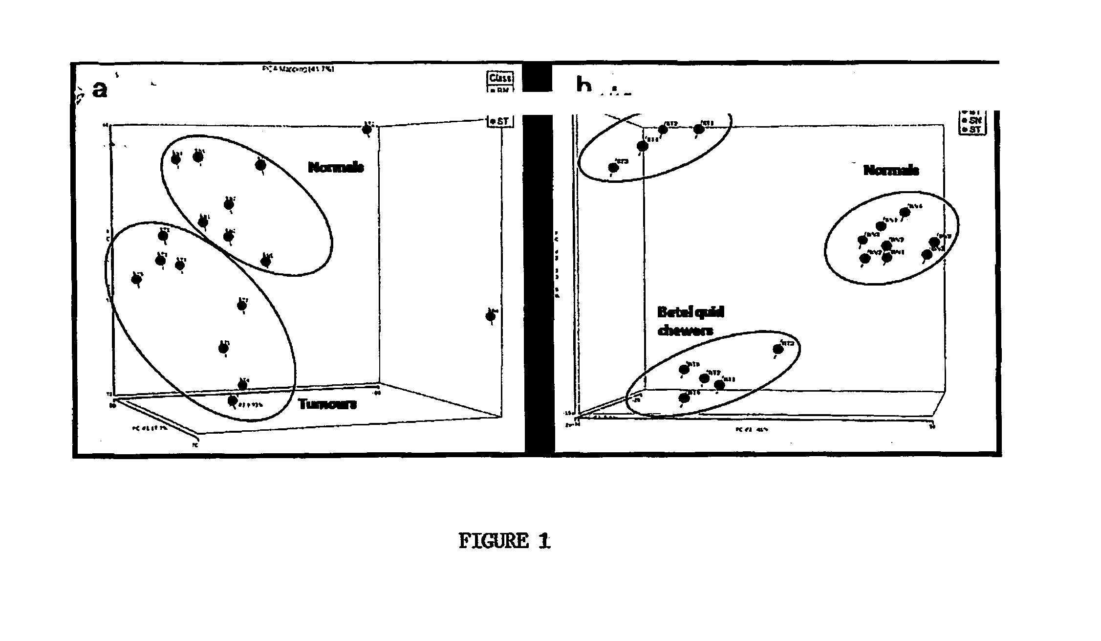 Method of detection and diagnosis of oral and nasopharyngeal cancers