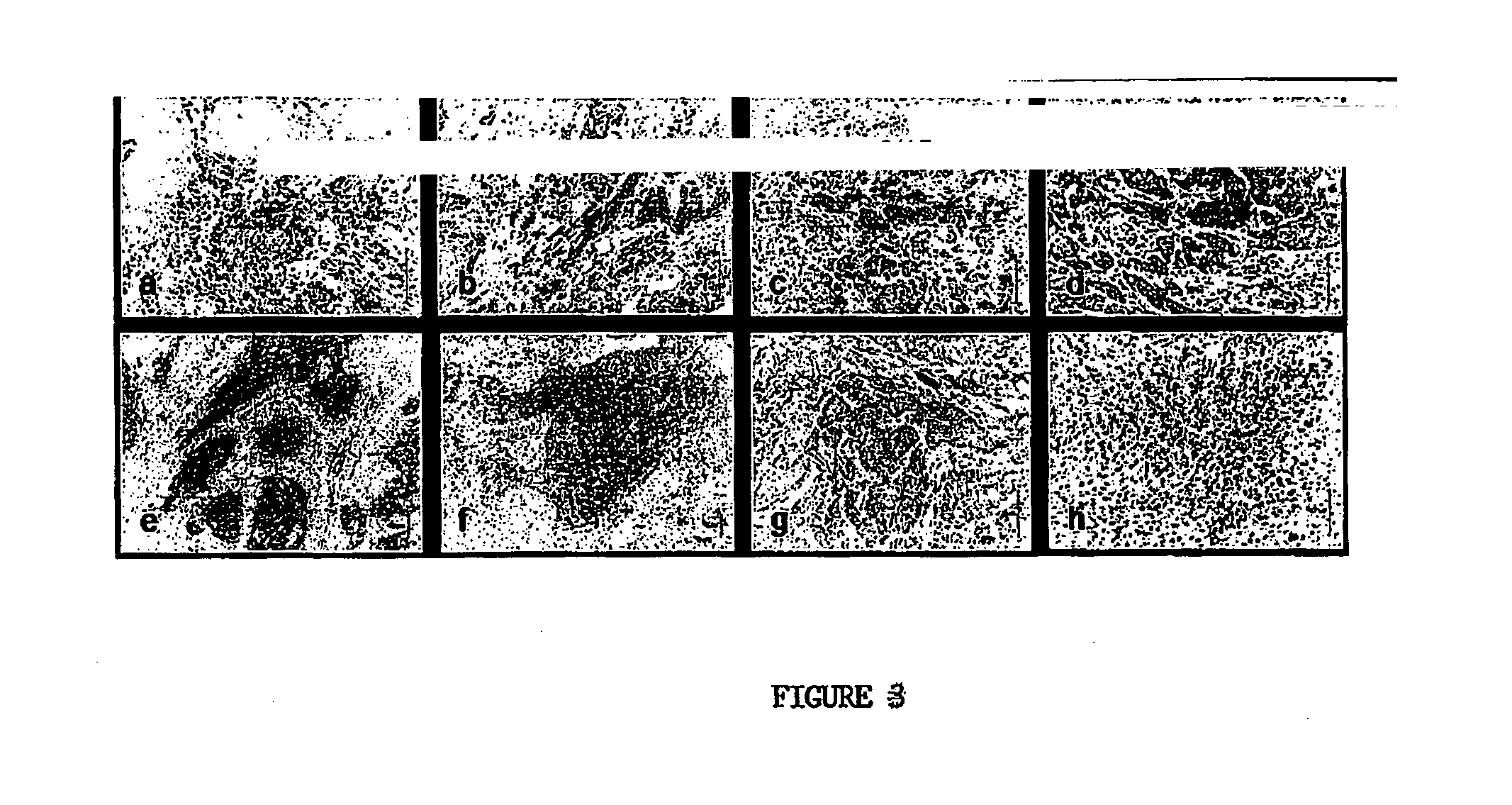 Method of detection and diagnosis of oral and nasopharyngeal cancers