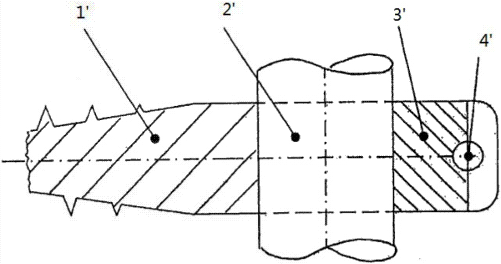 A dynamic prestressed clamping device for spinal implants and its installation method