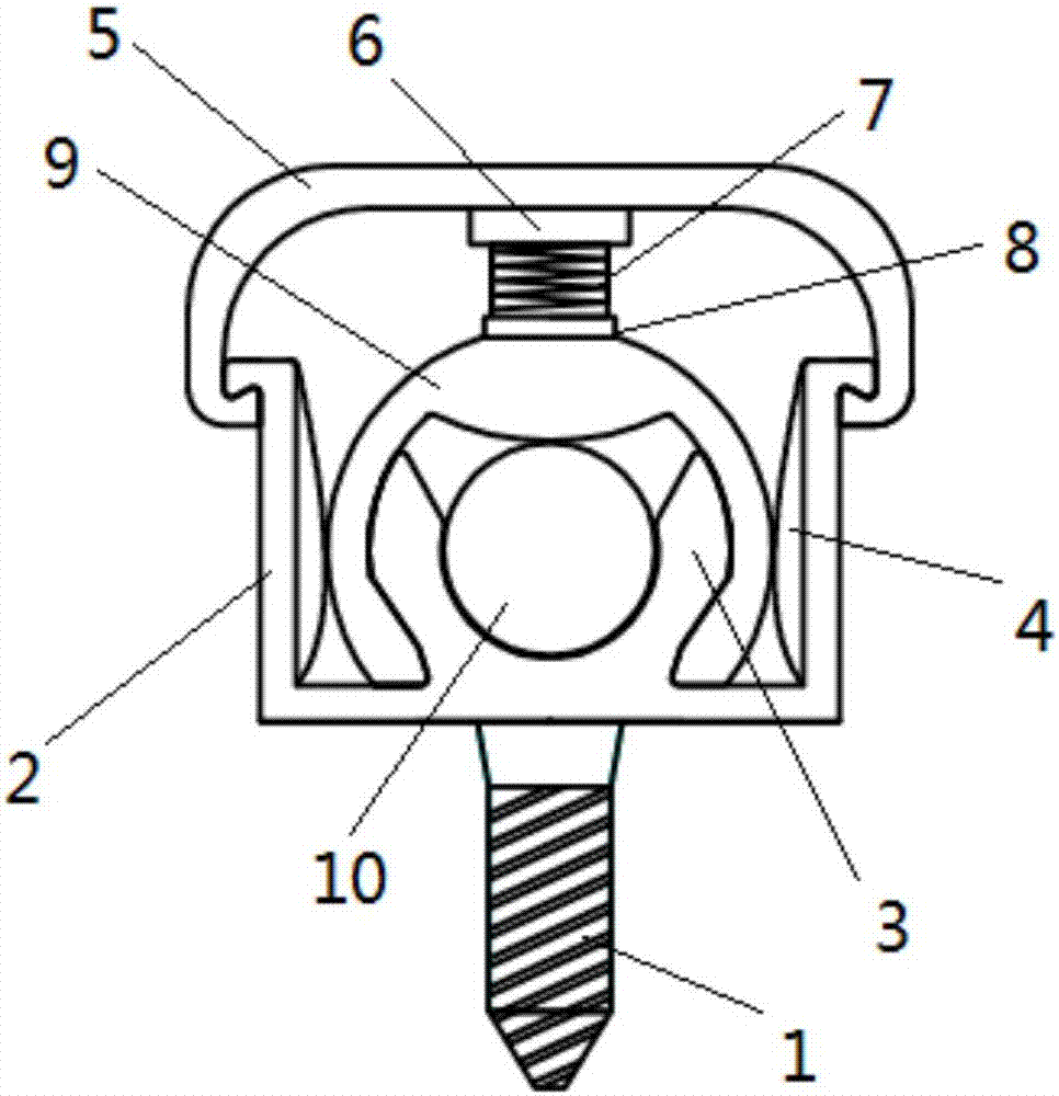 A dynamic prestressed clamping device for spinal implants and its installation method