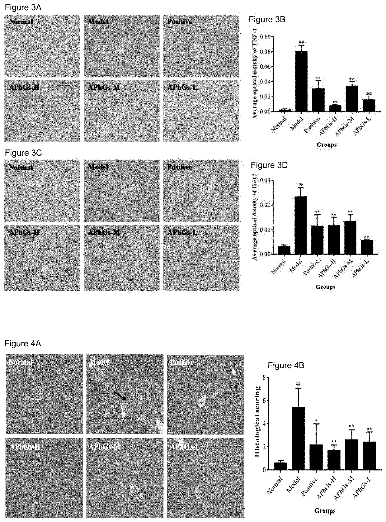 Phenylethanoid Glycoside Extract from Acanthus Ilicifolius L., Preparation Method thereof and Use as Anti-liver Injury Medicament