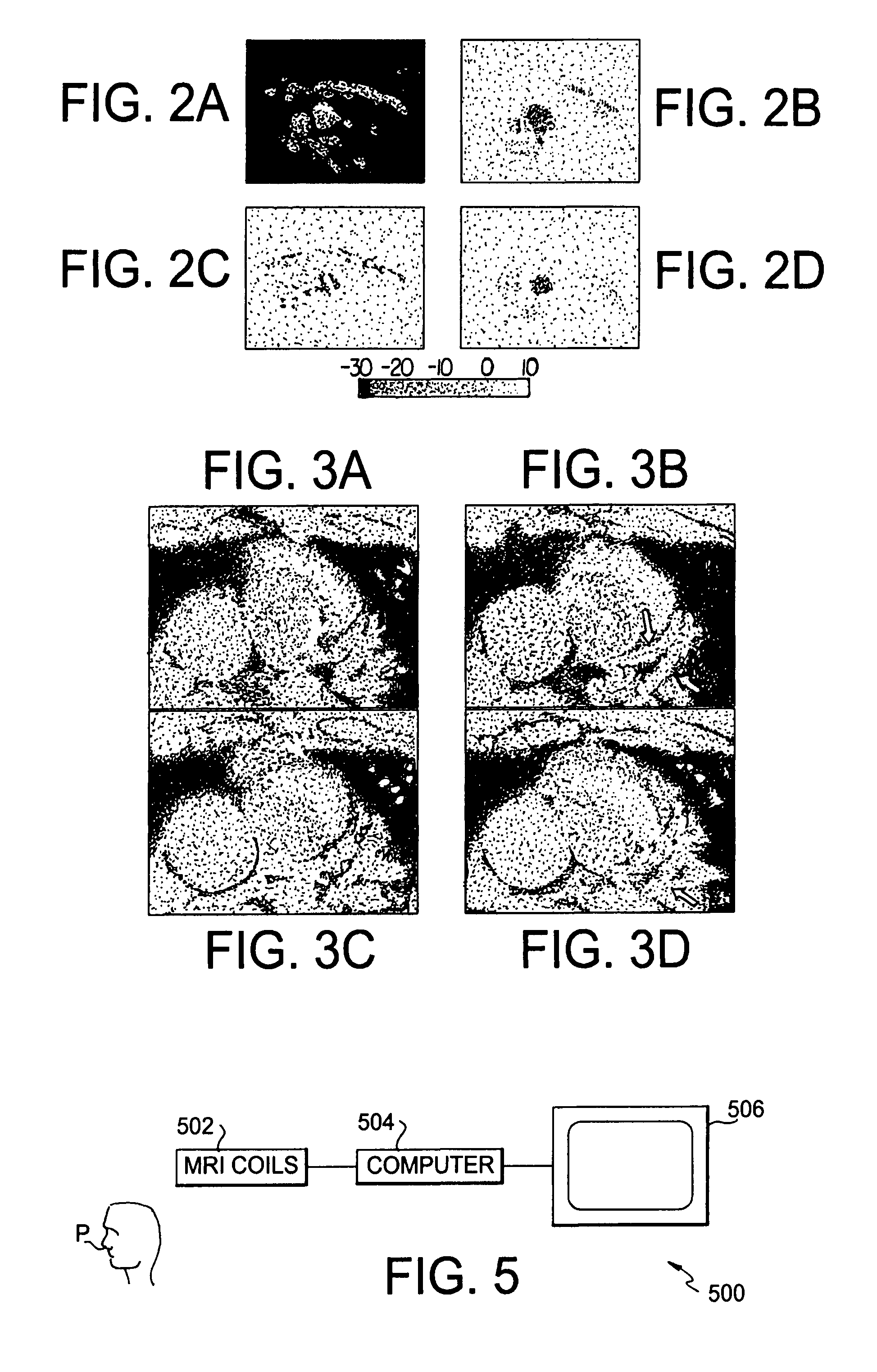 Fast automatic linear off-resonance correction method for spiral imaging