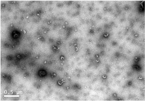 Controllable large-scale preparation method of NK cell exosomes