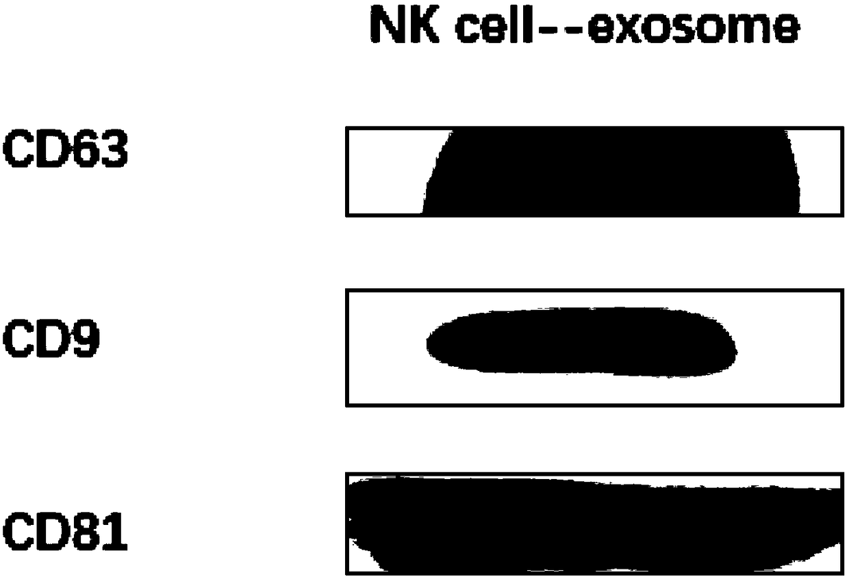 Controllable large-scale preparation method of NK cell exosomes