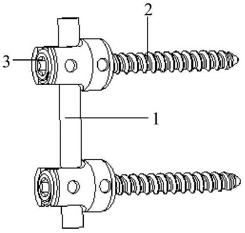 Thoracolumbar spine posterior approach micro-movement fixing system