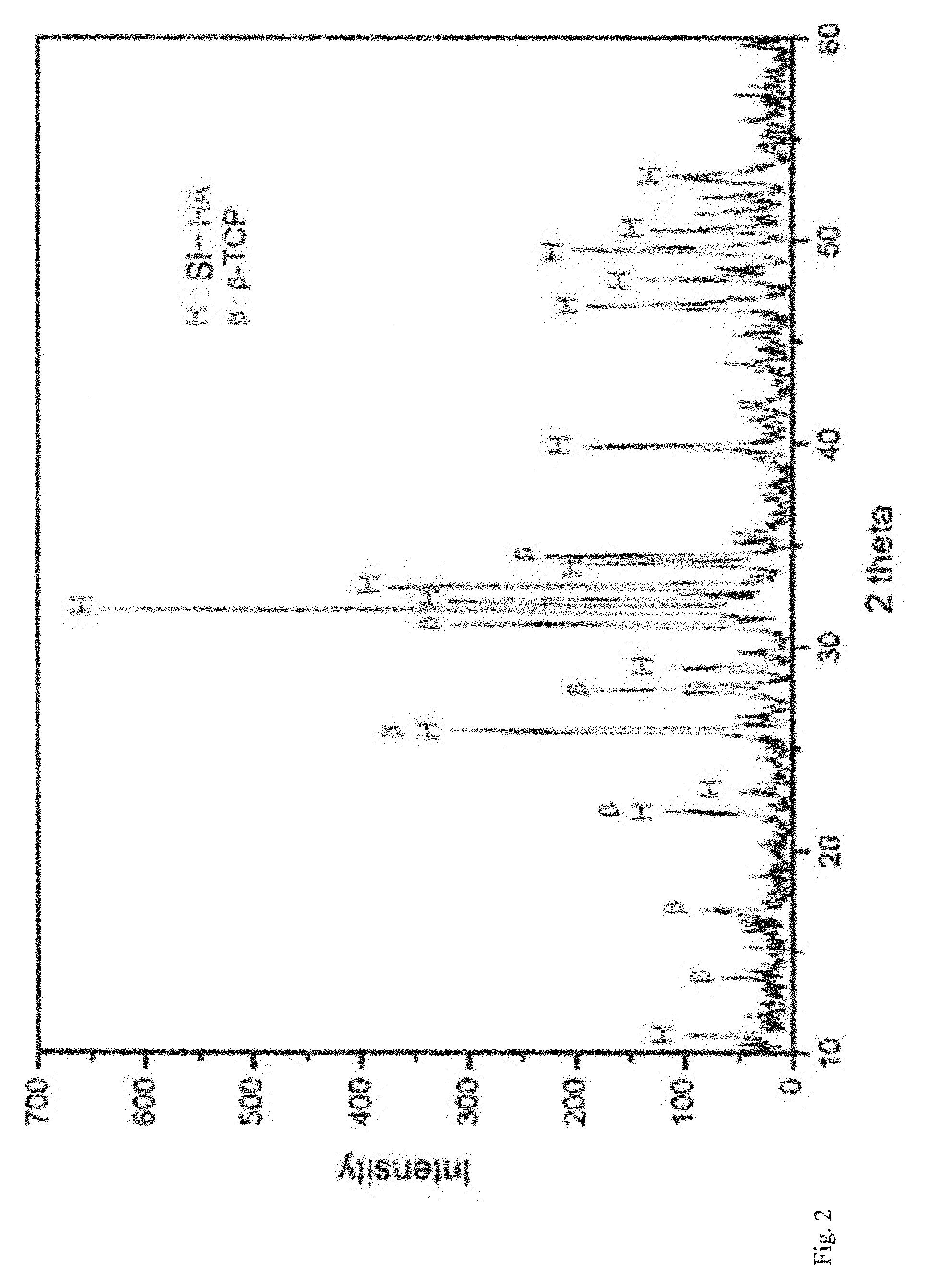 Porous composite comprising silicon-substituted hydroxyapatite and beta-tricalcium phosphate, and process for preparing the same