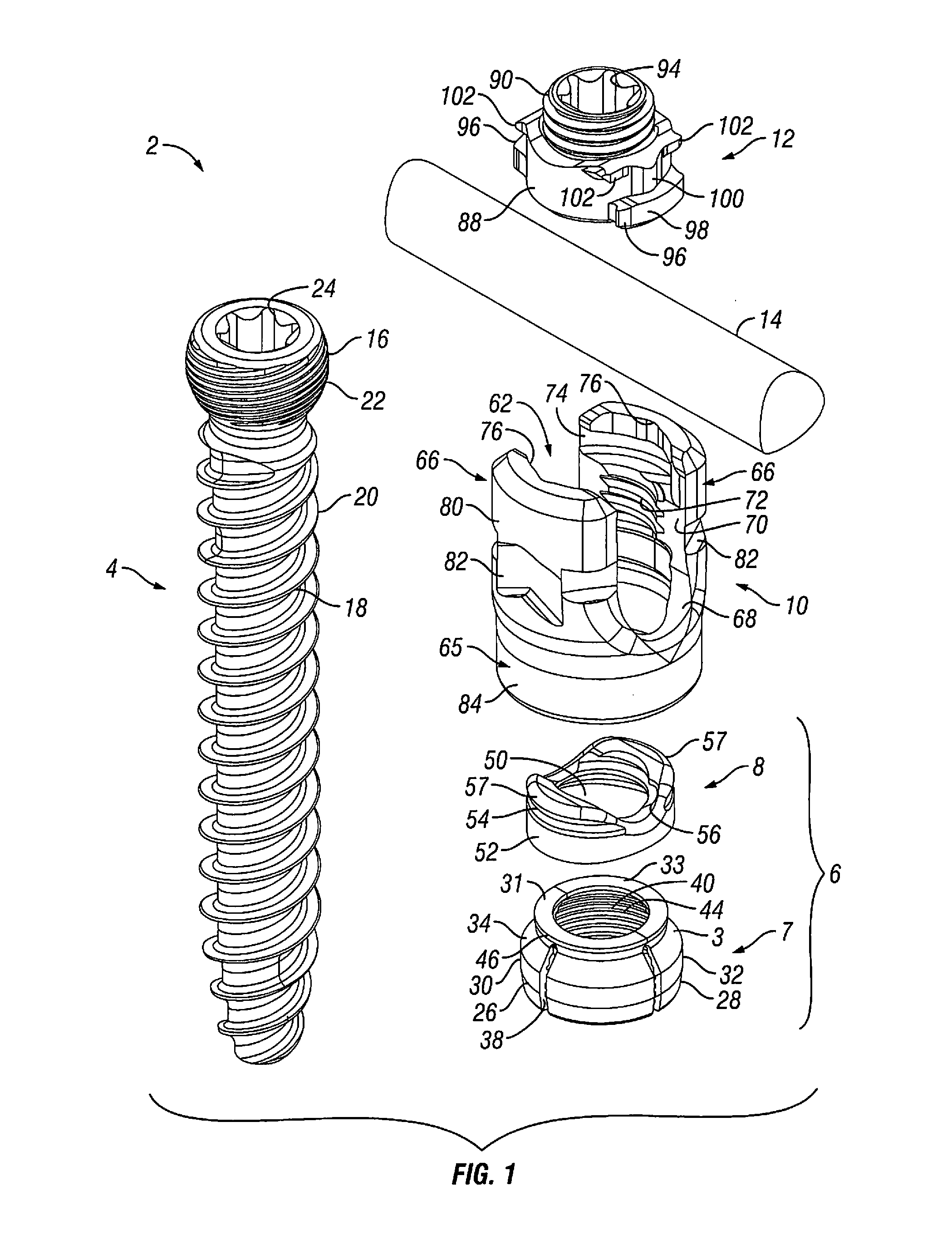 Orthopedic Fixation Devices and Methods of Installation Thereof