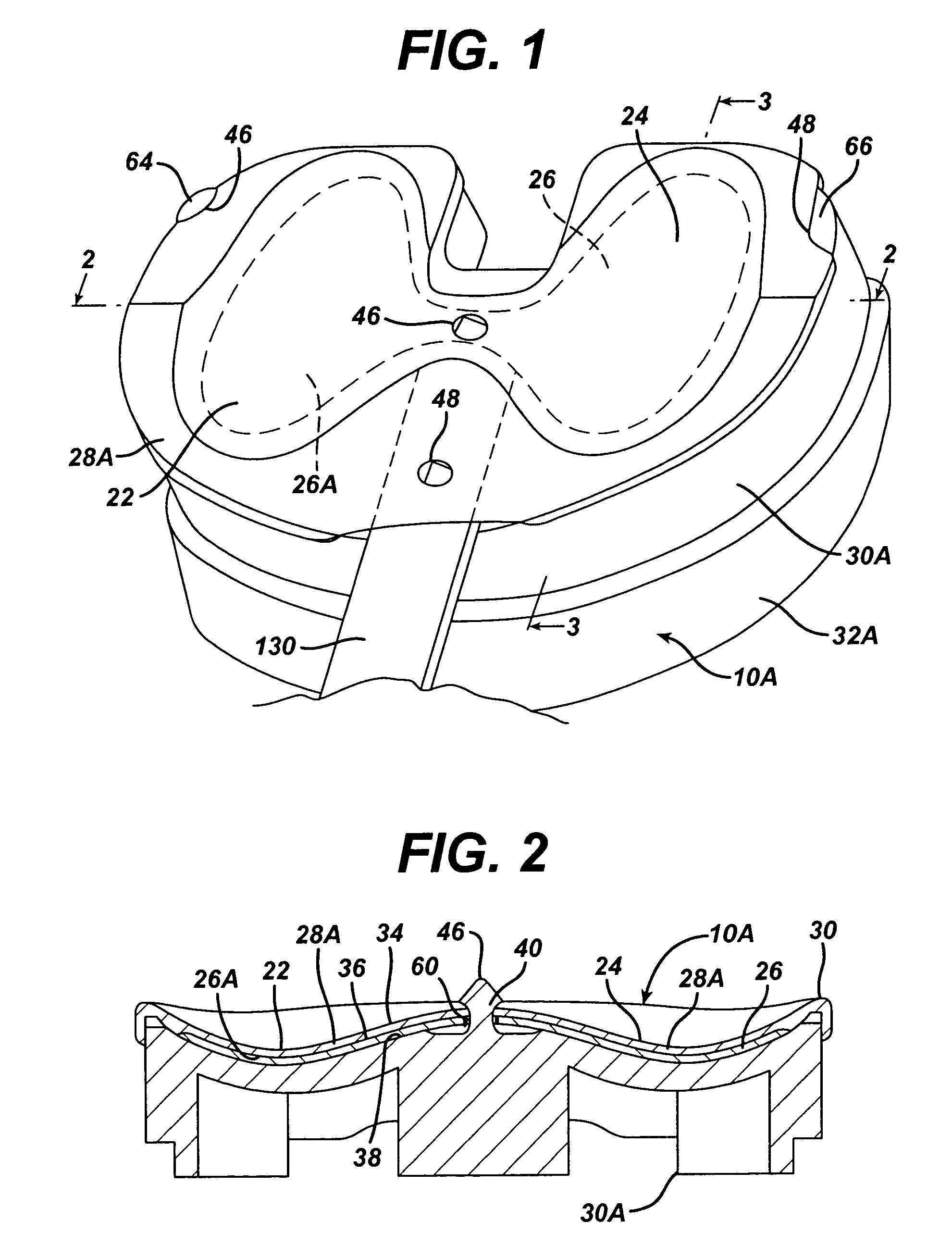 Modified system and method for intraoperative tension assessment during joint arthroplasty