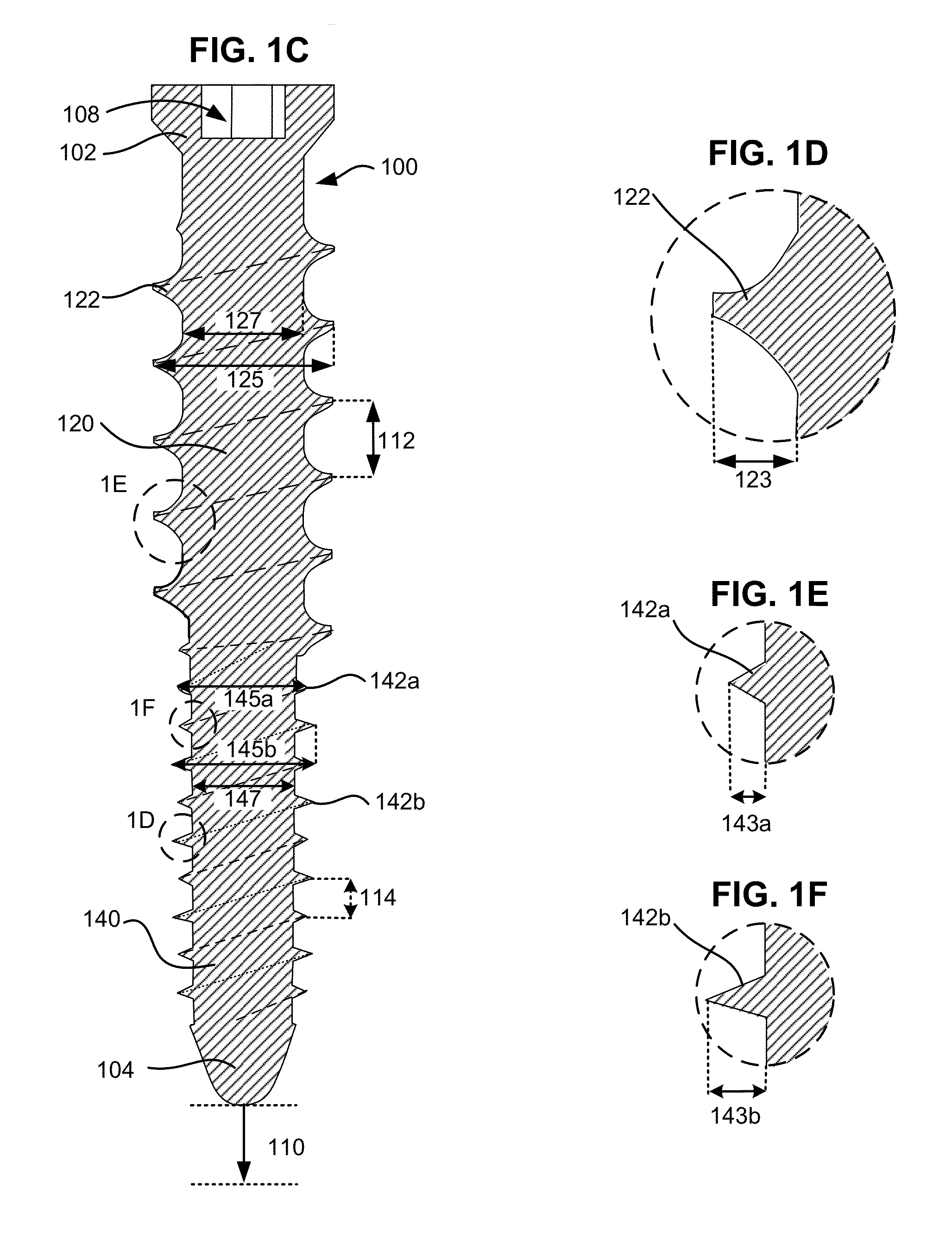 System and method for creating a bore and implanting a bone screw in a vertebra