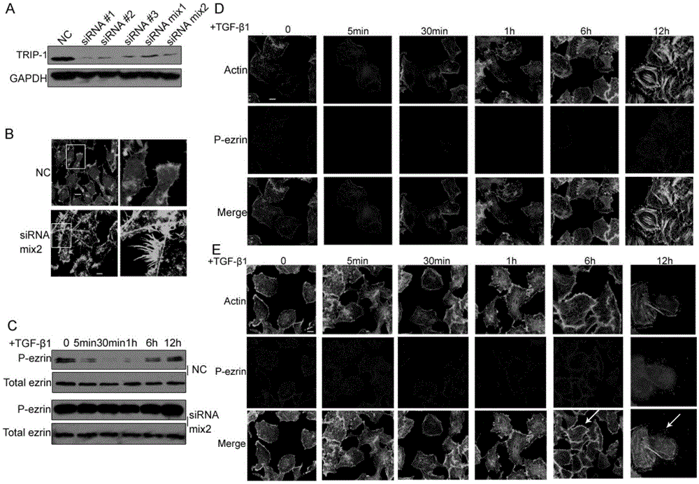 Uses of tgf-beta receptor binding protein-1