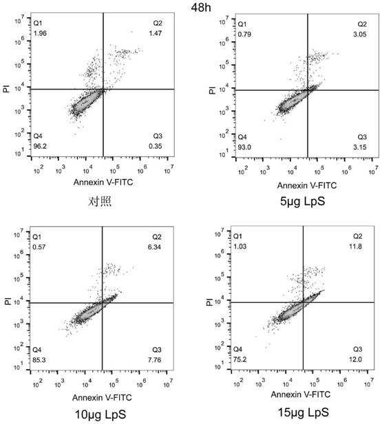 Application of lactic acid bacteria to preparing tumor prevention and treatment functional products by interfering lipid metabolism disorder