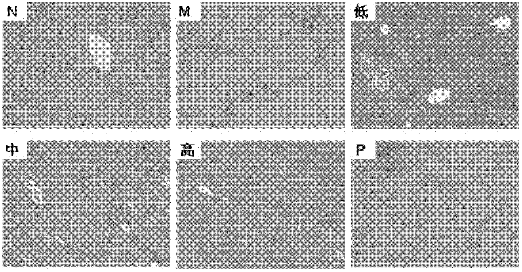 Traditional Chinese medicine composition for preventing and curing hepatic fibrosis, and preparation method and application thereof