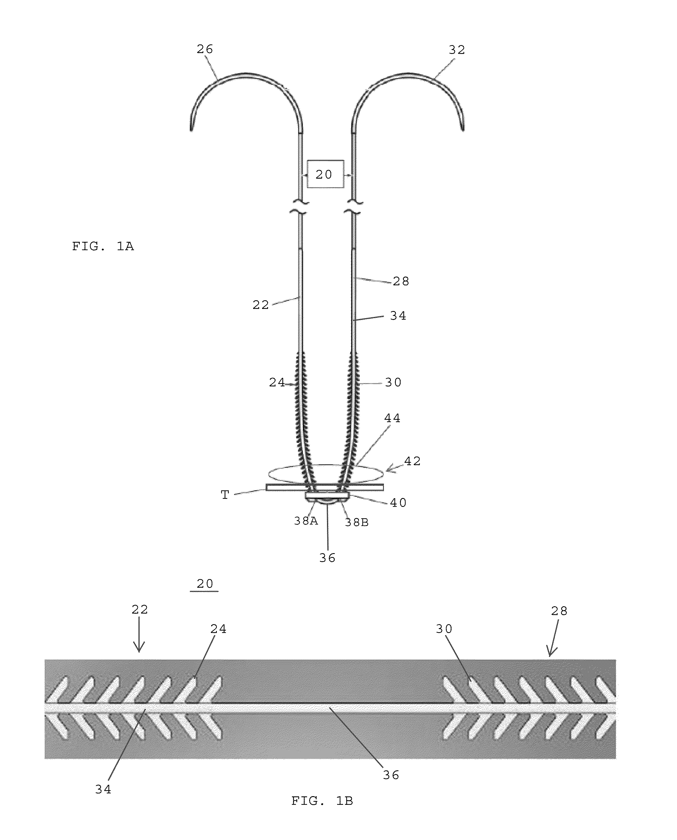 Barbed sutures having pledget stoppers and methods therefor