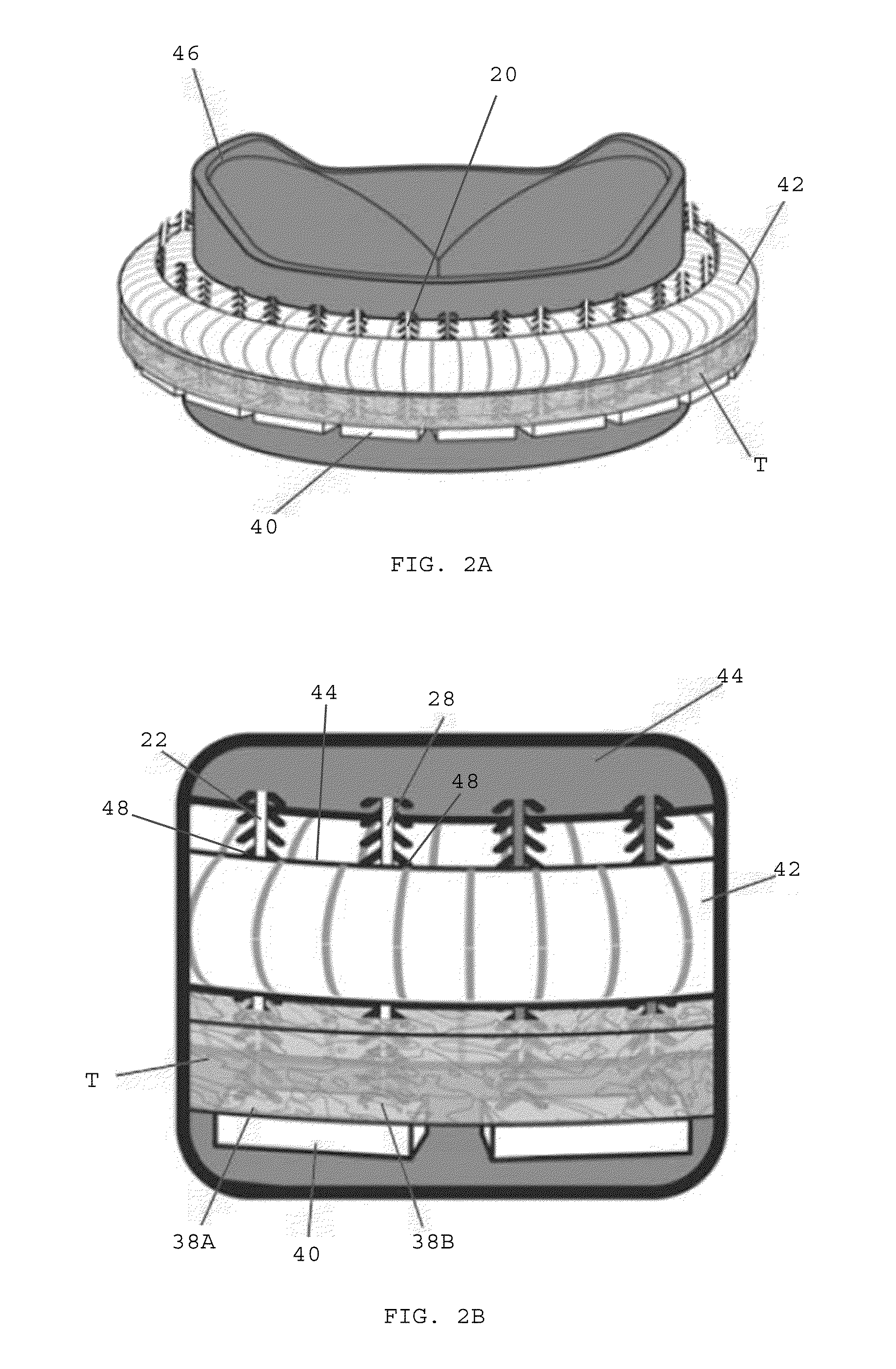 Barbed sutures having pledget stoppers and methods therefor