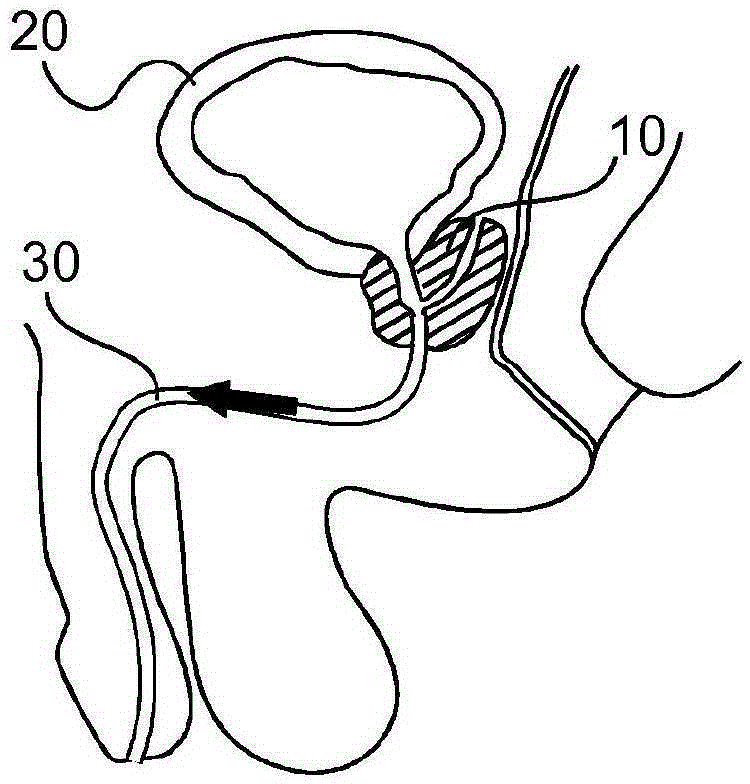 Method and system for localizing body structures