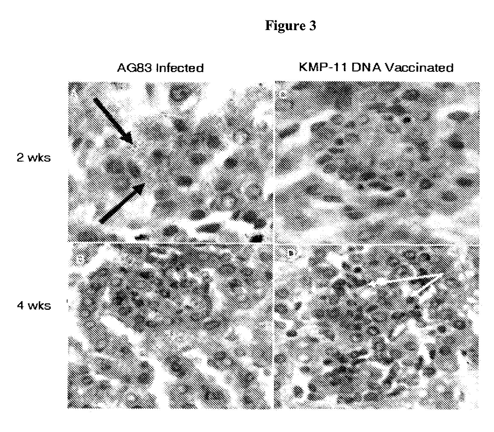 DNA vaccine as immunoprophylaxis against Kala-azar