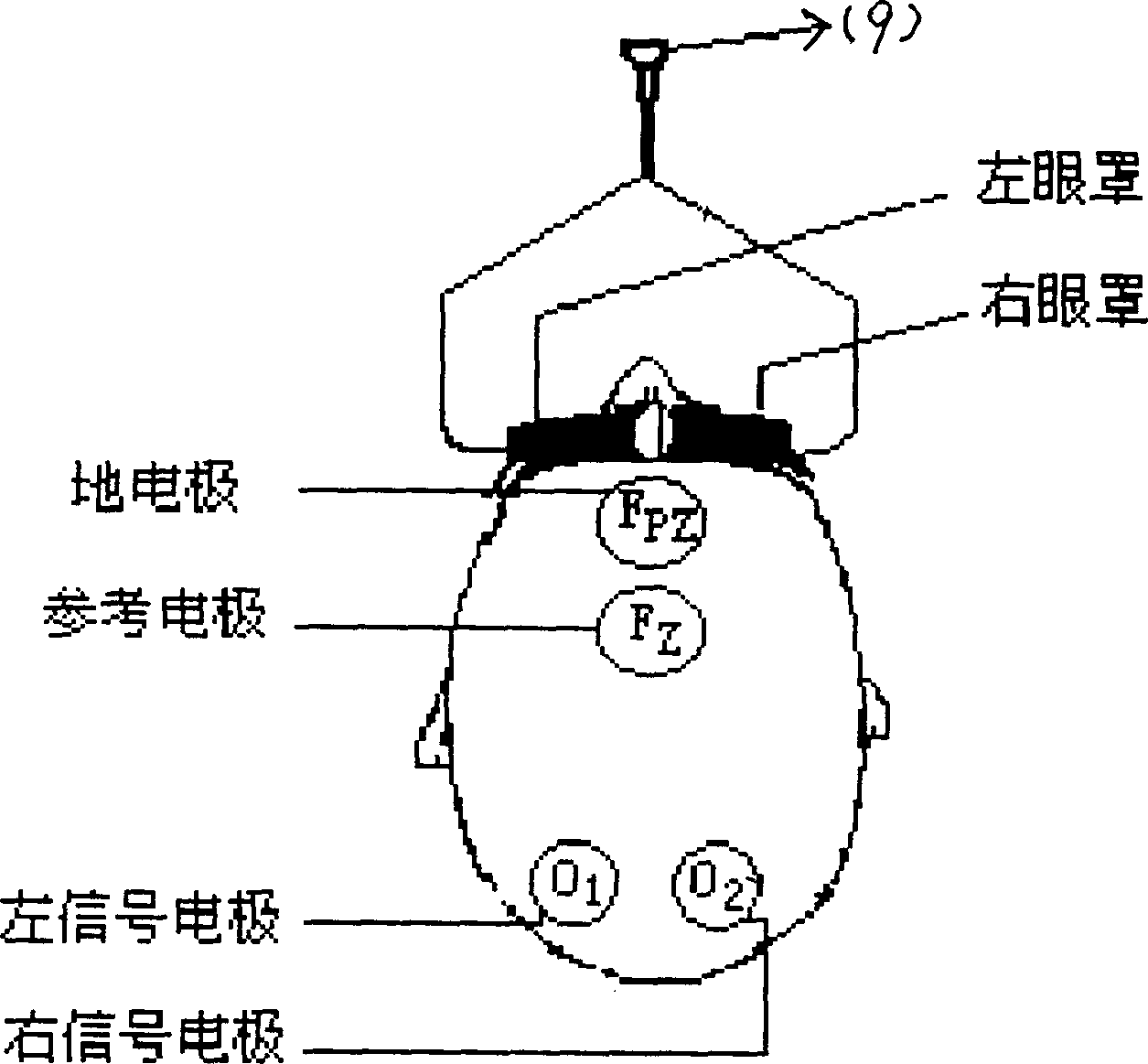 Wound-frce intracranial pressure monitoring method and apparatus