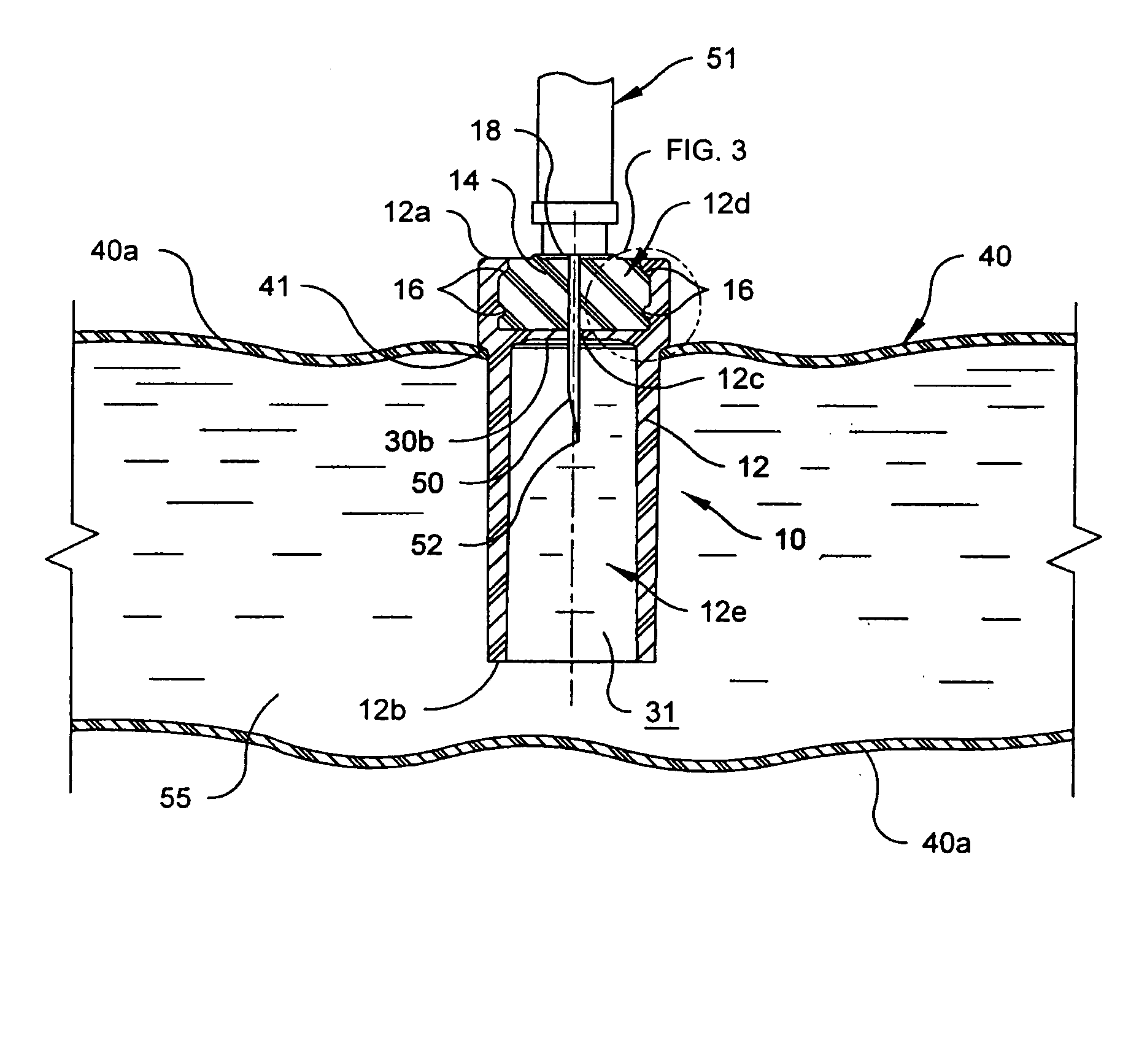 Injection port and method of making the same
