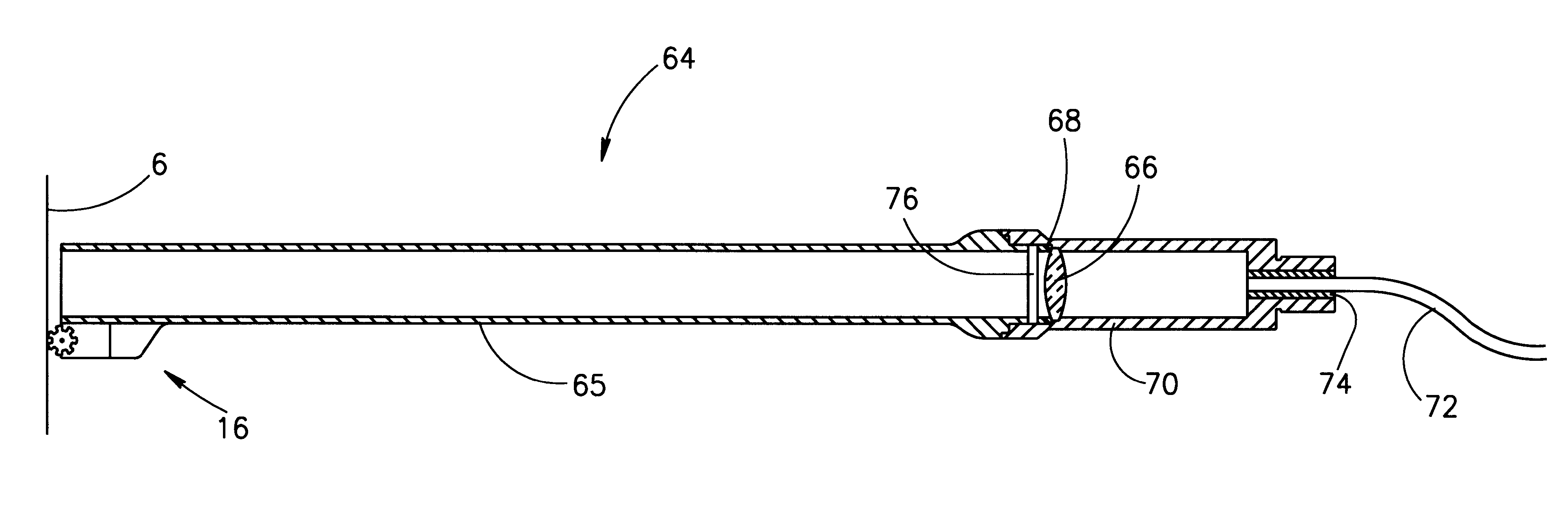 Apparatus and method including a handpiece for synchronizing the pulsing of a light source