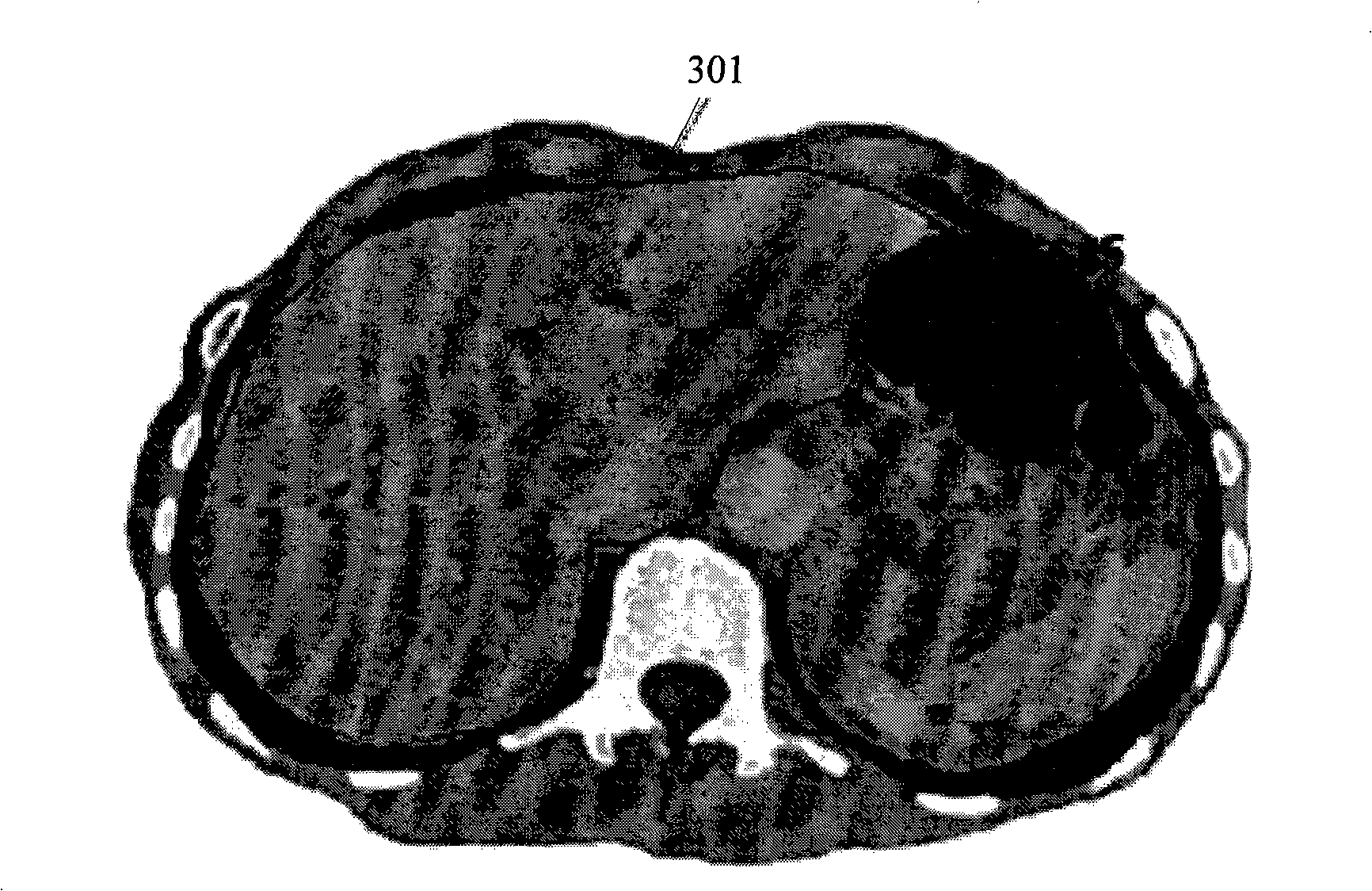 Three-dimensional visualization method and device