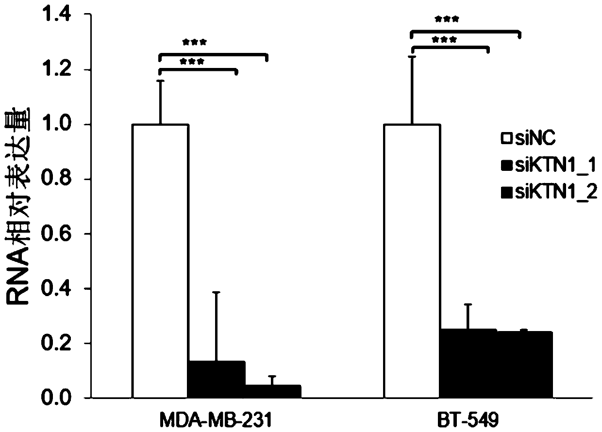 Application of yy1 expression inhibitor in preparation of medicament for breast cancer